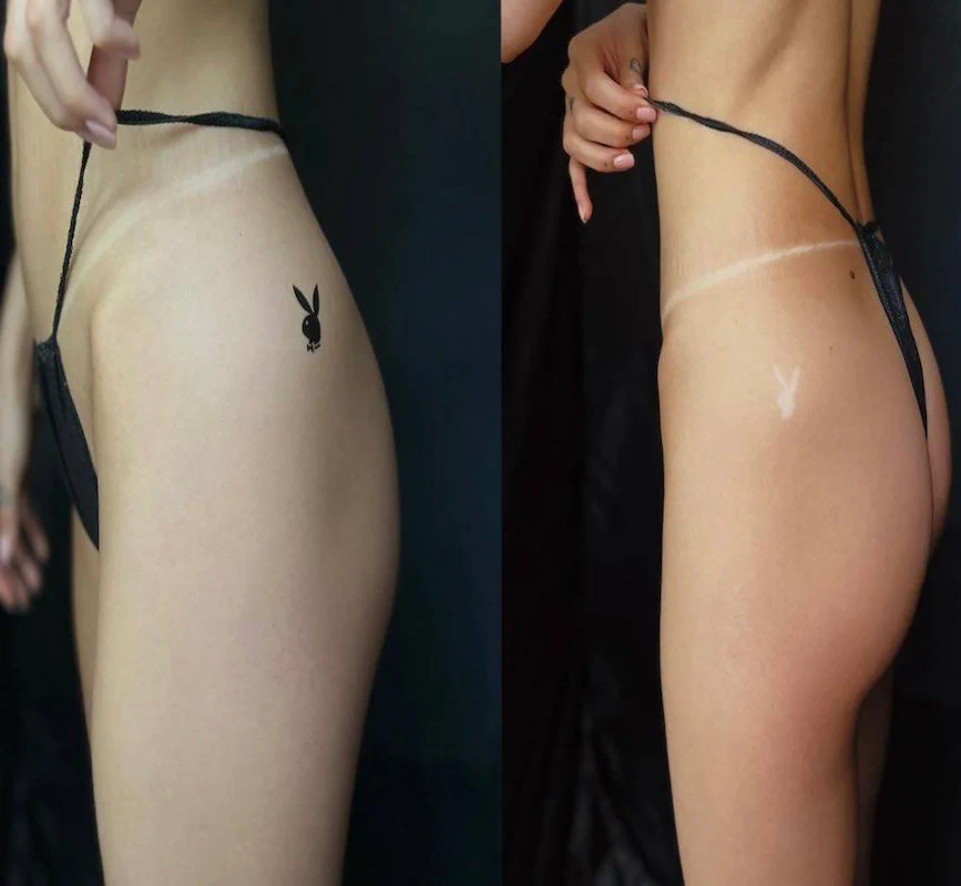 Після тростинної засмаги