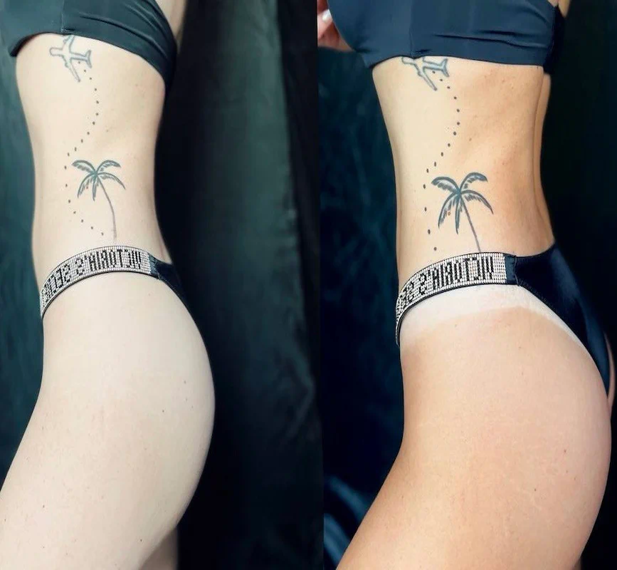 До тростинної засмаги — фото 3